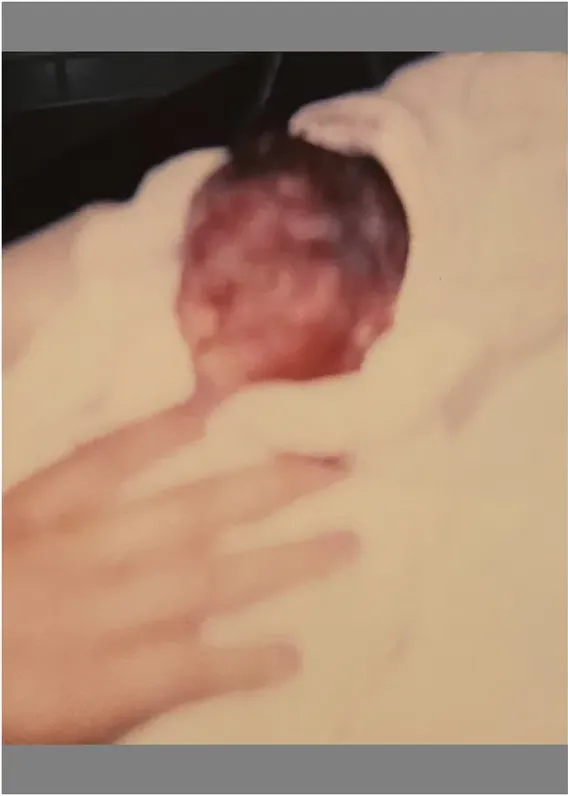 Original 1980s-plus photograph showing discoloration, before photo restoration by MemoryCherish