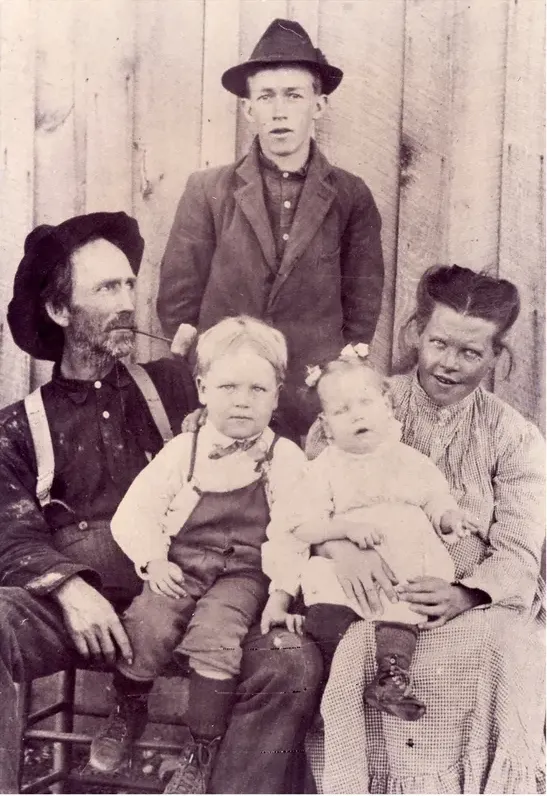 Discoloration on a pre-1950 photograph, before hand restoration by MemoryCherish artists